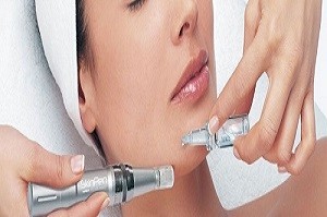 Ansigtsbehandlinger Skin Pen